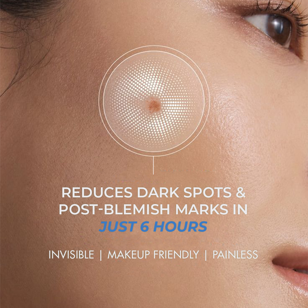 Dark Spot Lightening Microneedle Patch | Gallic Acid, Niacinamide | Results in 6 hrs | Self Dissolving | 4 Patches