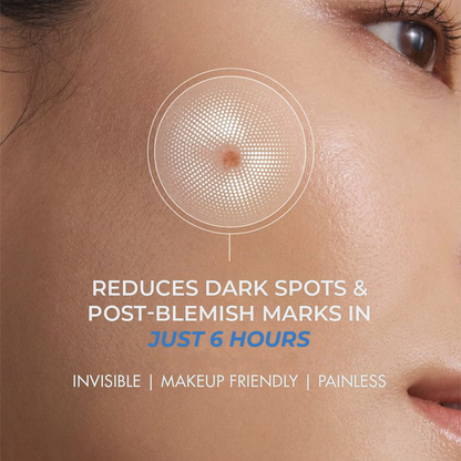 Dark Spot Lightening Microneedle Patch | Gallic Acid, Niacinamide | Results in 6 hrs | Self Dissolving | 4 Patches